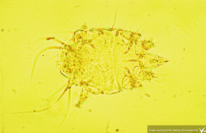 Tracheal Mite under microscope
