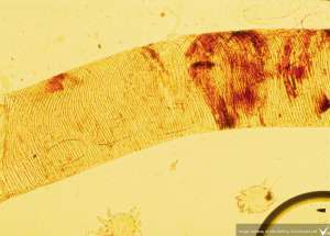 tracheal mites in honey bee trachea under microscope